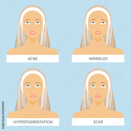 Skin problems: acne, wrinkles, hyper pigmentation, scars