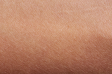Pattern of human skin