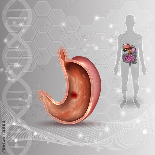 Stomach ulcer, internal organs anatomy colorful drawing on an abstract scientific DNA background
