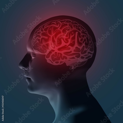 Healthcare and migraine concept - vector illustration