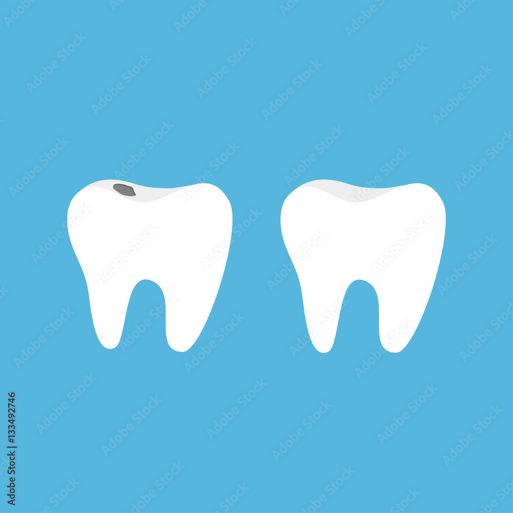 Healthy and bad ill tooth icon set with caries. Oral dental hygiene. Children teeth care. Blue background. Flat design.