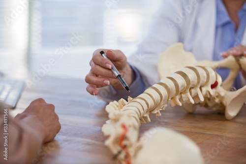Doctor explaining anatomical spine to patient photo