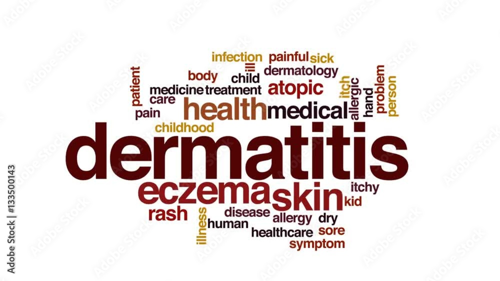 Dermatitis animated word cloud, text design animation. Dermatitis animated word cloud, text design animation.