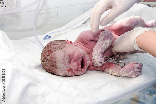 Newborn baby after birth in hospital