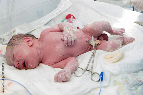 Newborn baby after birth in hospital