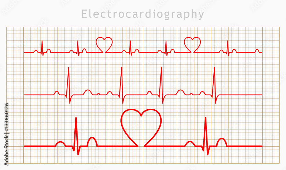 Vector Heart cardiogram charts set