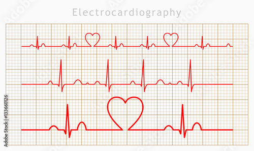 Vector Heart cardiogram charts set