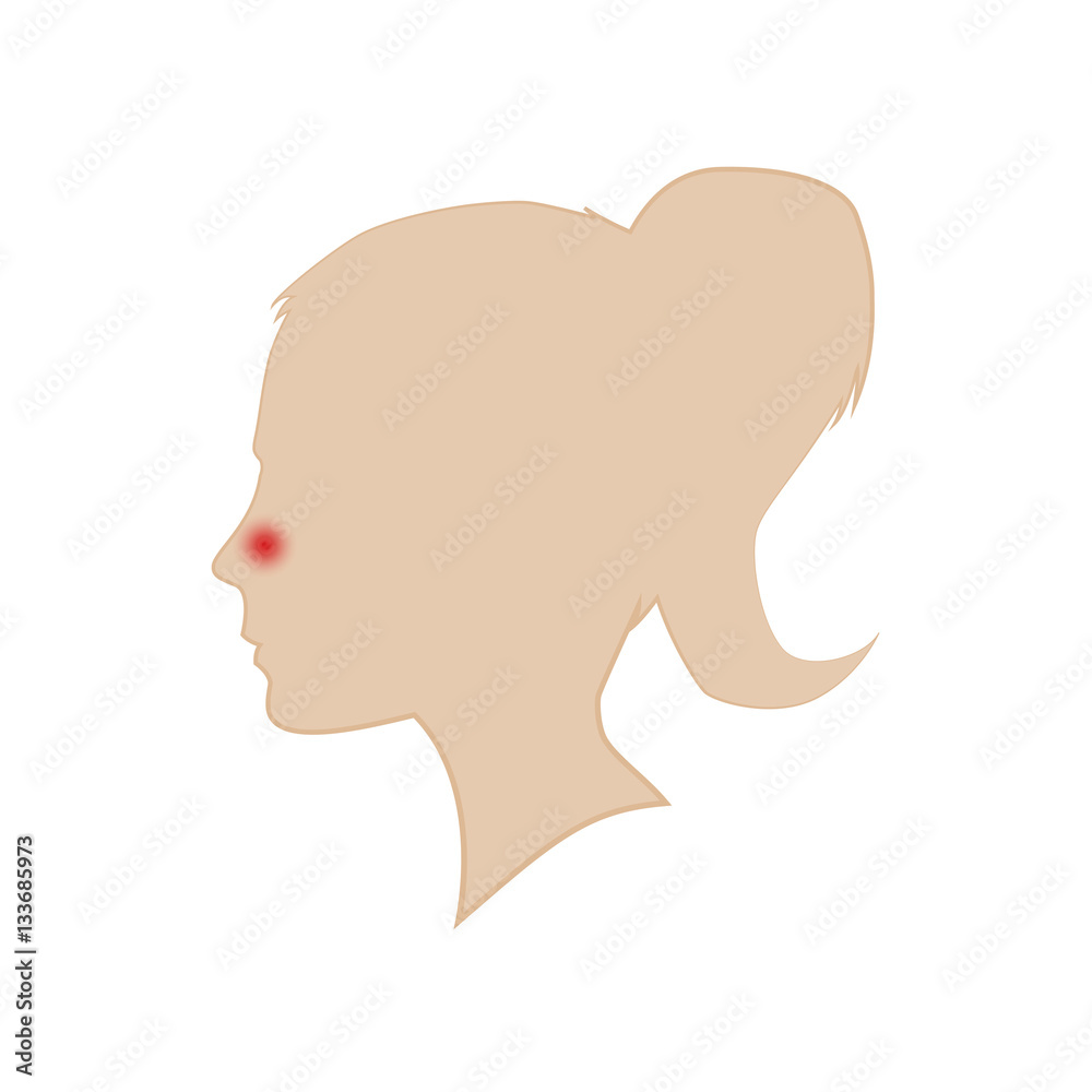 Silhouette of a woman's head. Runny nose. Vector.