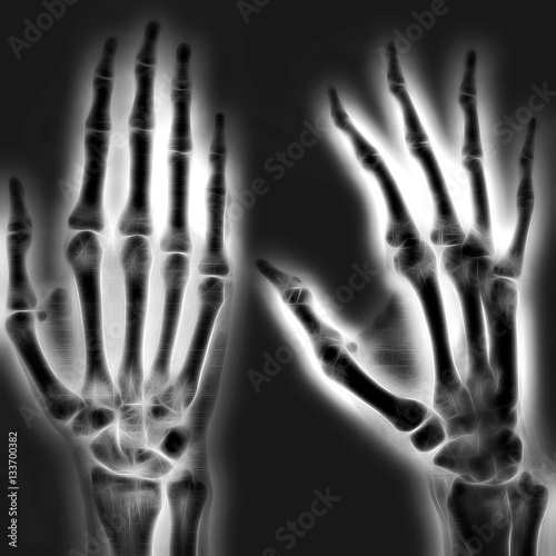 Illustrated image of a human hand with X-ray technology