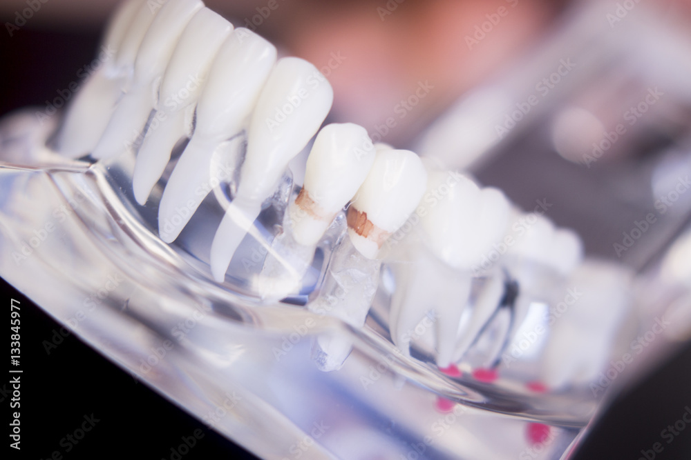 Dentists dental teeth model Dentists dental teeth model