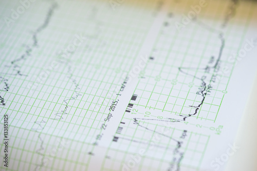 Wallpaper Mural Printing of cardiogram report coming out from Electrocardiograph in labour ward Torontodigital.ca