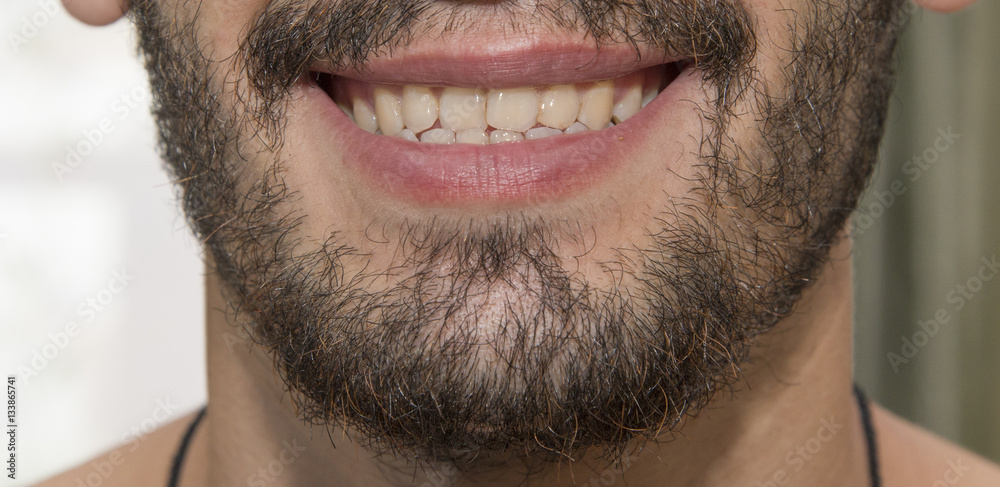 Fototapeta premium The bearded man smiles, showing bad teeth.