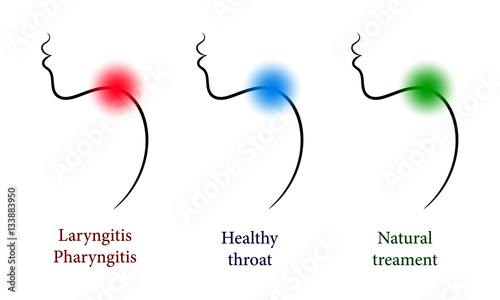 Otorhinolaryngology set with healthy and sore throat
