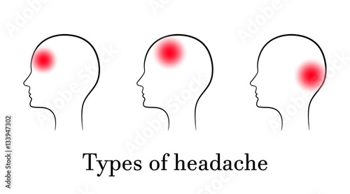 Types of headache, contour medical concept