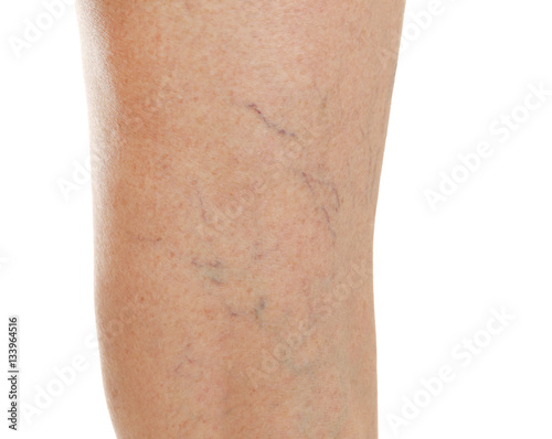 Female leg on white background, closeup