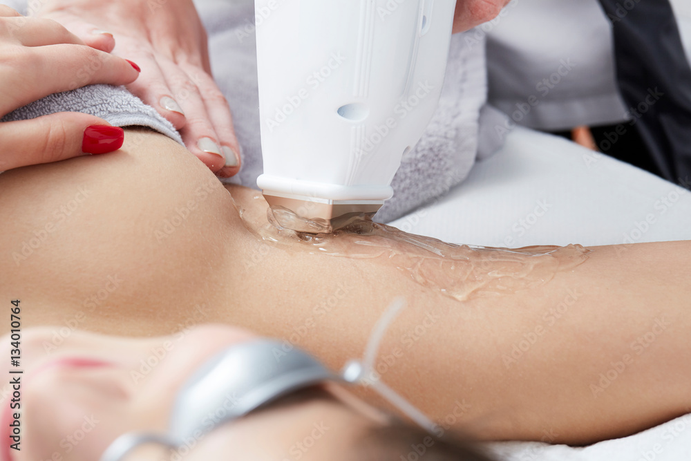 Φωτογραφία Beautician Giving Epilation Laser Treatment To Woman On underarm