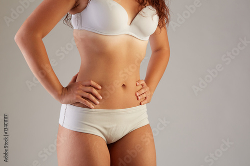 Unretouched skin exhibits stretch marks and other imperfections.