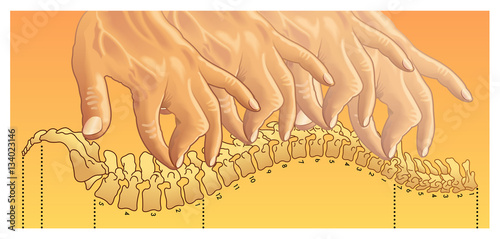 chiropractic