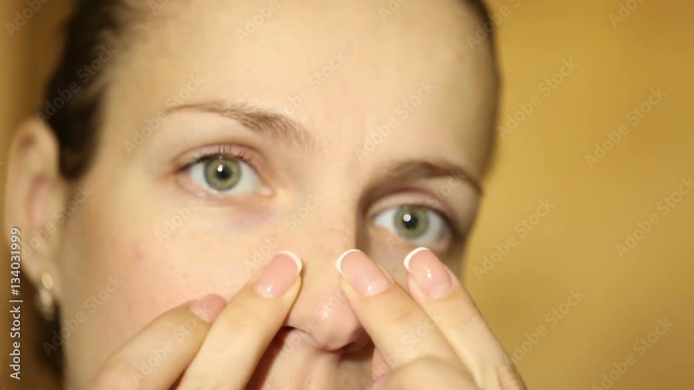 young beautiful girl squeezes pimples on the nose young beautiful girl squeezes pimples on the nose