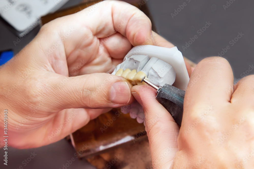 Fototapeta premium Technical shots on a dental prothetic laboratory