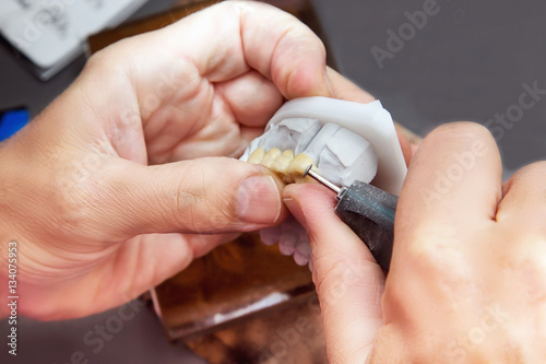 Technical shots on a dental prothetic laboratory photo