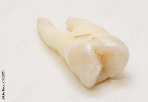 human tooth close-up