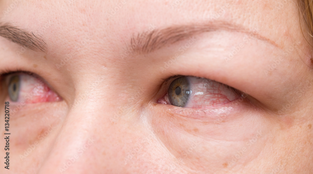 Obraz premium red eyes