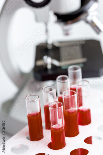 blood in glass tubes on background of microscope
