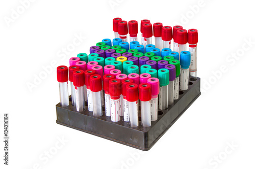 chemical test tubes