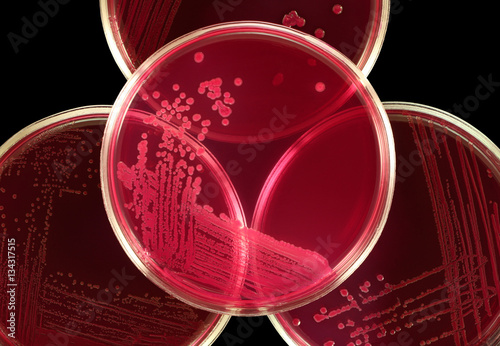 Biohazard / biosafety sign composed by petri plates with red agar Endo. Central dish close-up. Colonies of Escherichia coli microbes. Isolation by pen.