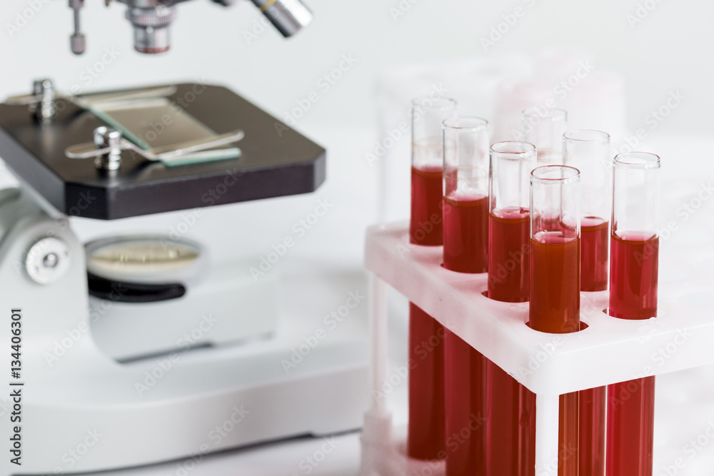 blood in glass tubes on background of microscope blood in glass tubes on background of microscope