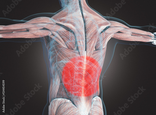 Muscoli lombardi con dolore o rossore photo
