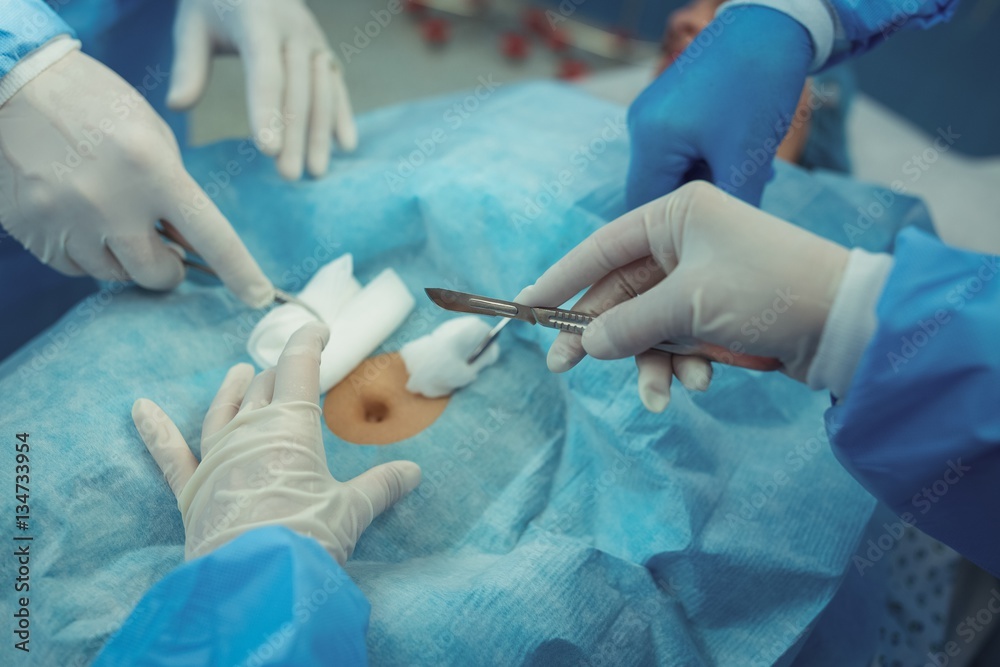 Team of surgeons performing operation in operation theater Team of surgeons performing operation in operation theater