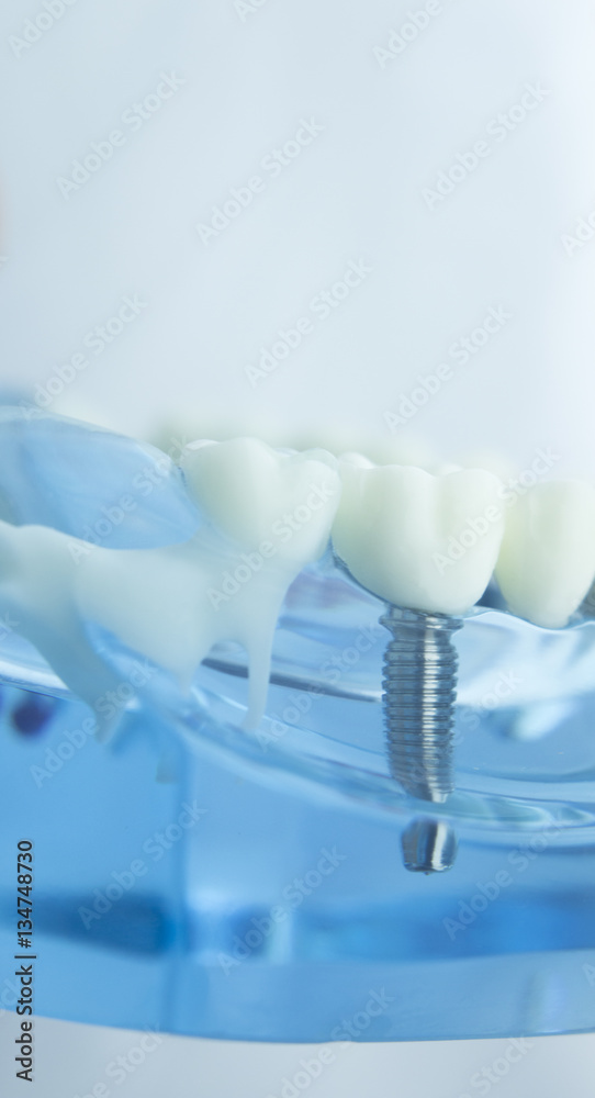 Dental teeth dentistry model Dental teeth dentistry model