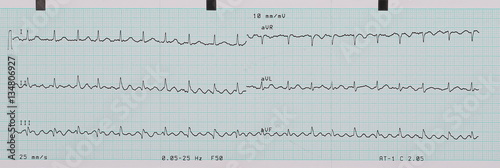 EKG printout background and texture