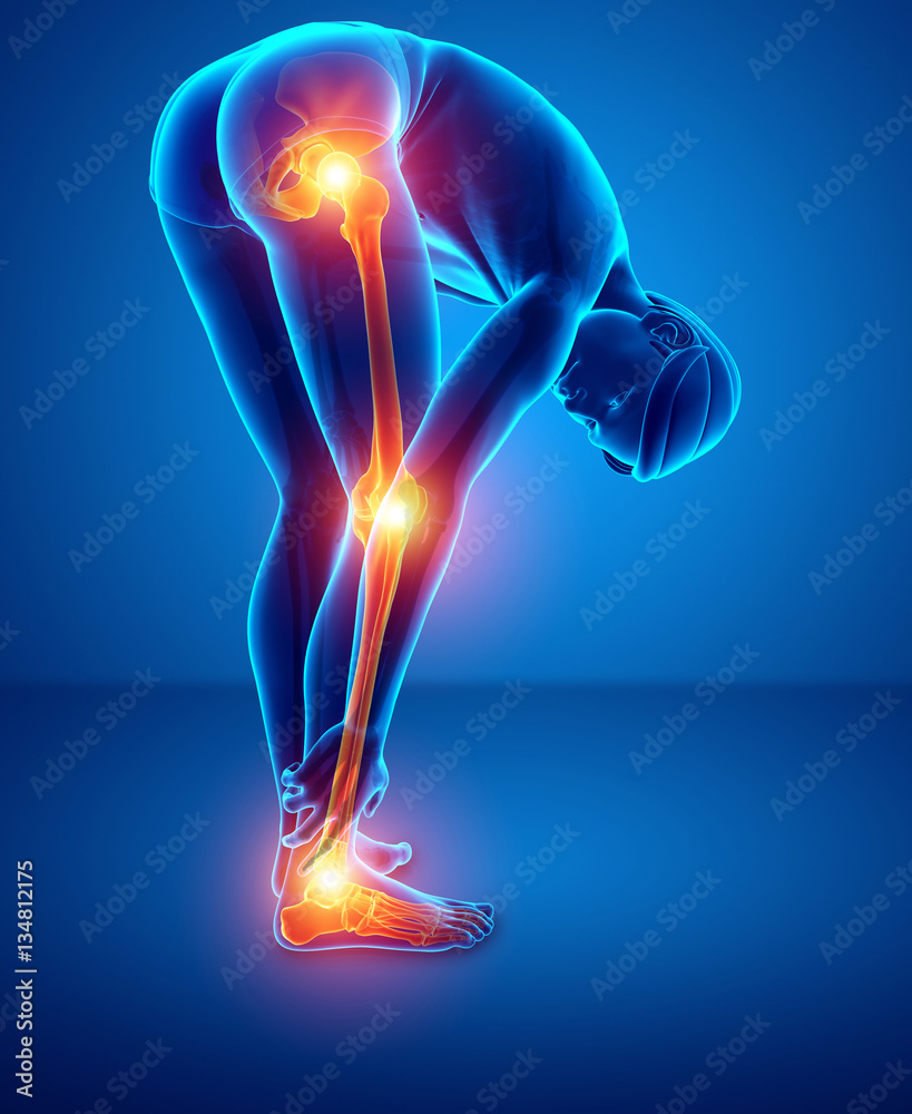Pain in leg Pain in leg