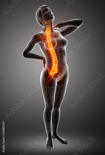 Women Feeling the Back pain © pixdesign123