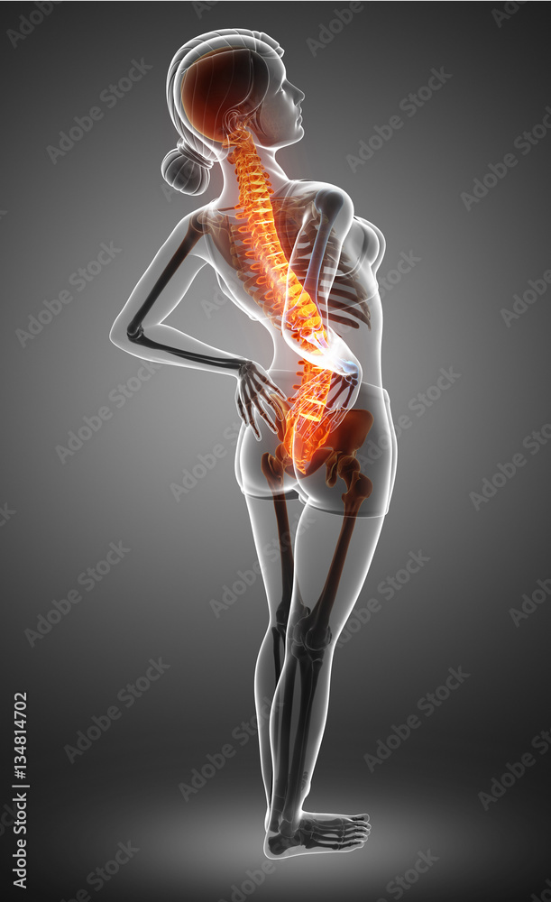 Obraz premium Women Feeling the Back pain