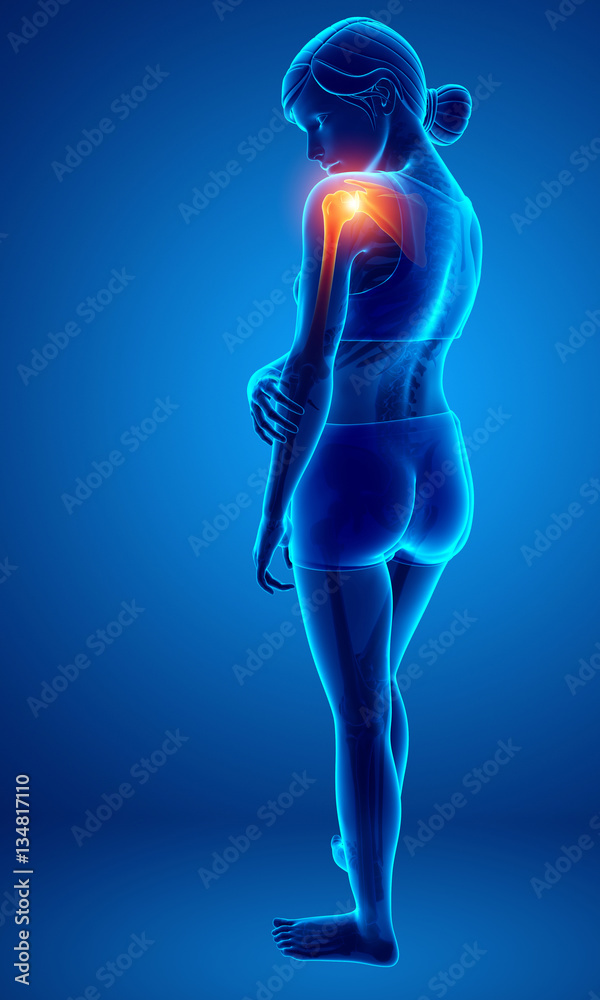 Women Feeling the Shoulder Pain