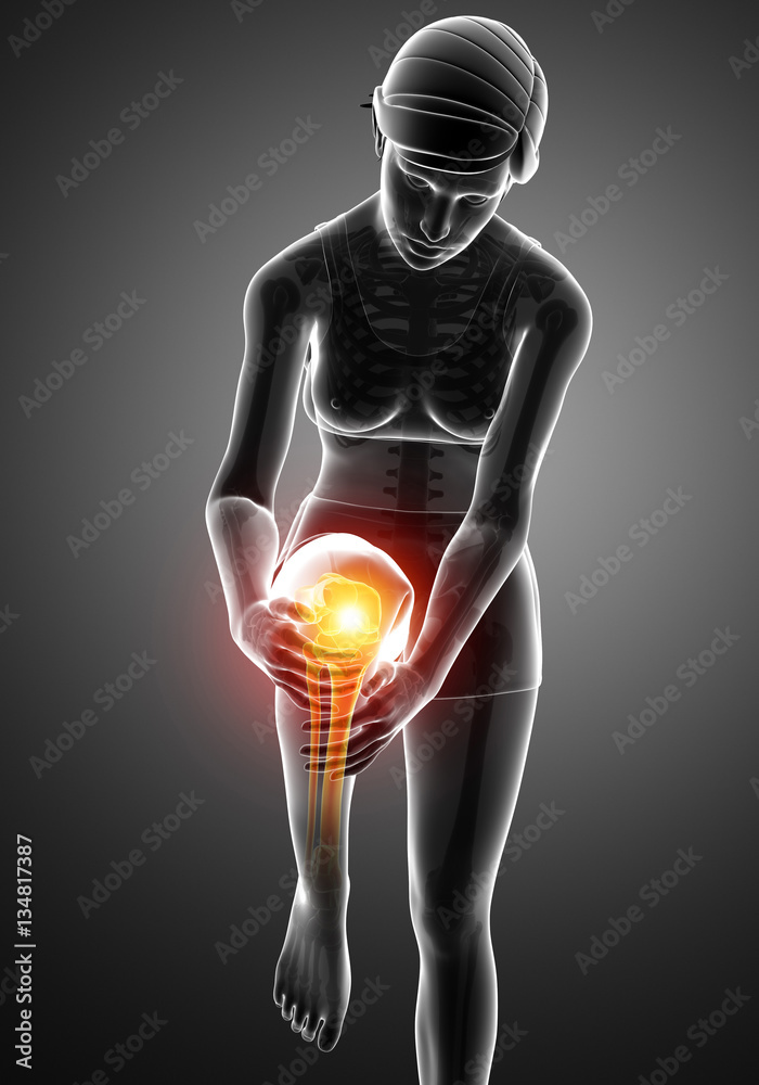 Women Knee joint pain