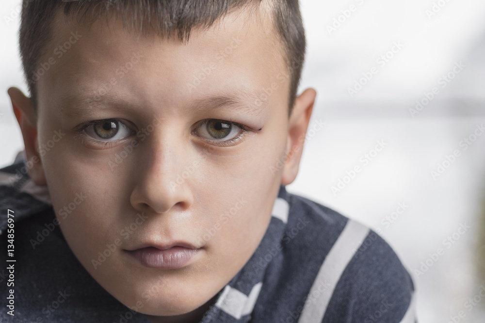 Sad Boy. Teenager with Sad Expression Face Close Up. Depression, Loneliness and Stress Concept. Sad Boy. Teenager with Sad Expression Face Close Up. Depression, Loneliness and Stress Concept.