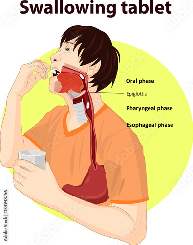 Vector illustration of Swallowing tablet