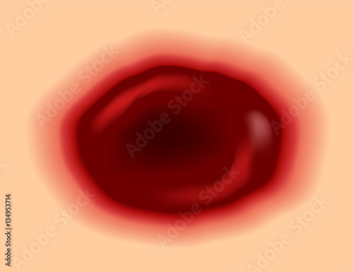wound skin vector graphic . blood come out of wound