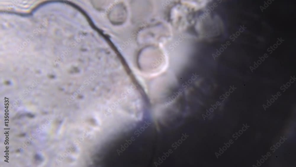 Footage on the theme blood, diseases, interstitial fluid, bacterial background, research using a microscope at extreme magnification of about 1000x