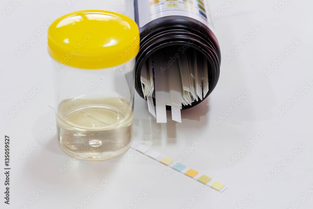 Urine sample Urine sample