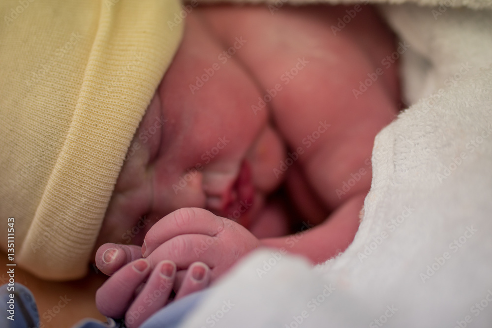 Baby born with cheap hand on face