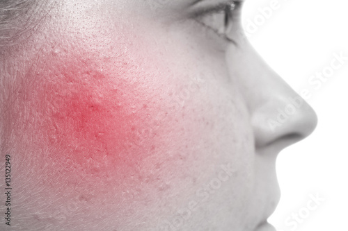 Skin care concept. Young wo...