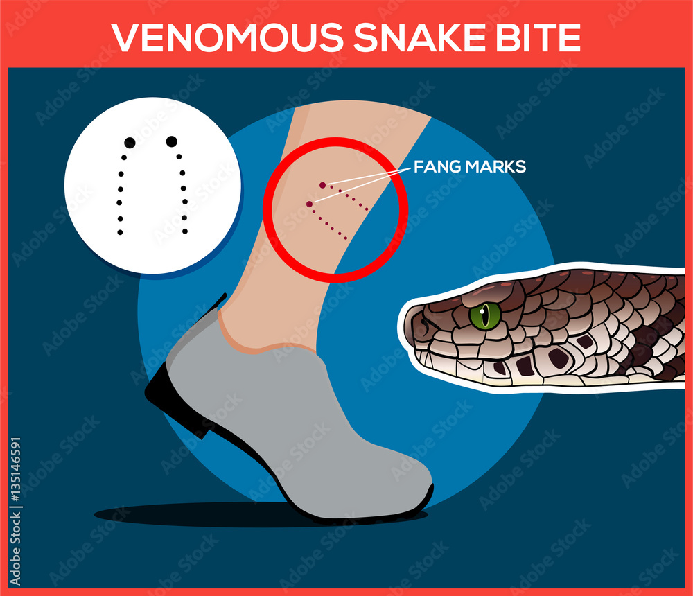 Fototapeta premium Venomous snake bite in the leg. Snakebite. Beware of snakes. Flat vector illustrations