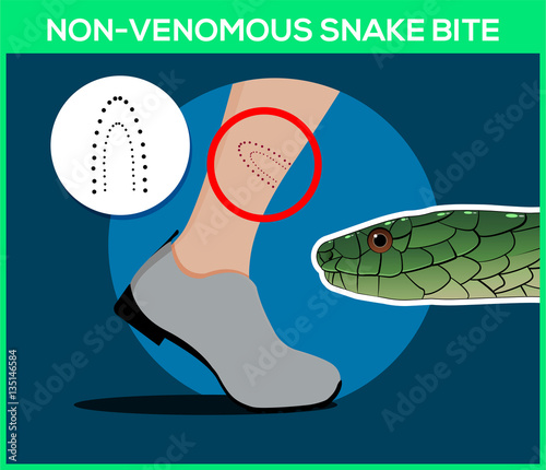 Non-venomous snake bite in the leg. Snakebite. Beware of snakes. Flat vector illustrations