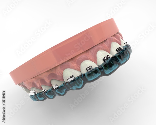 3d rendering teeth